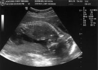 Ultrasound_081017_10.jpg